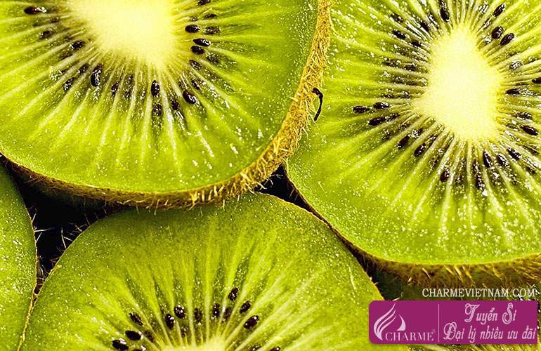 Quả Kiwi
